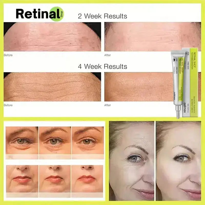 Korean Vita A Retinol Shot Tightening Booster Firming Enhancer Moisturizing Pore Shrinking Dark Circles Repair Serum Skin Care Retinal Shop