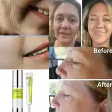 Retinal Shot Tightening Booster (Original) Korean Skin, discounts offers Retinal.Shop