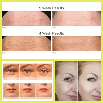 Retinal Shot Tightening Booster (Original) Korean Skin, discounts offers Retinal.Shop